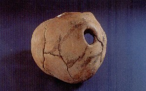 廣饒縣傅家村出土的392號墓墓主頭蓋骨洞口